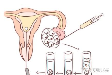 关于供卵代怀生男宝代生包成功